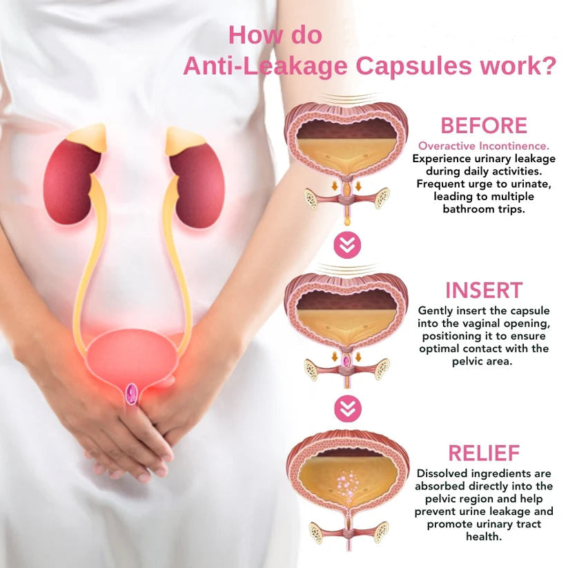 Urinary Anti-Leakage Capsules
