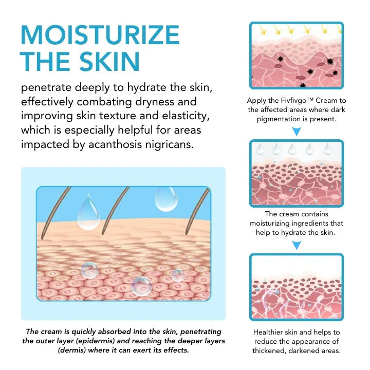 Acanthosis Nigricans Lightening Cream