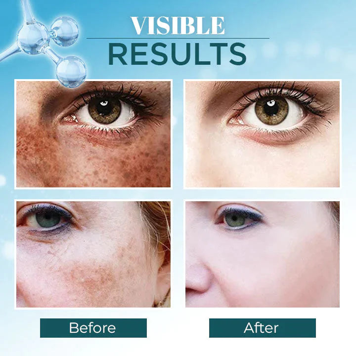 Triple-Active Brightening Dark Spot Corrector Remover