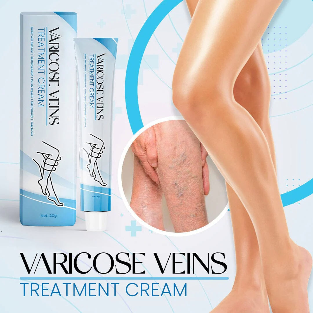 Varicose Veins Treatment Cream