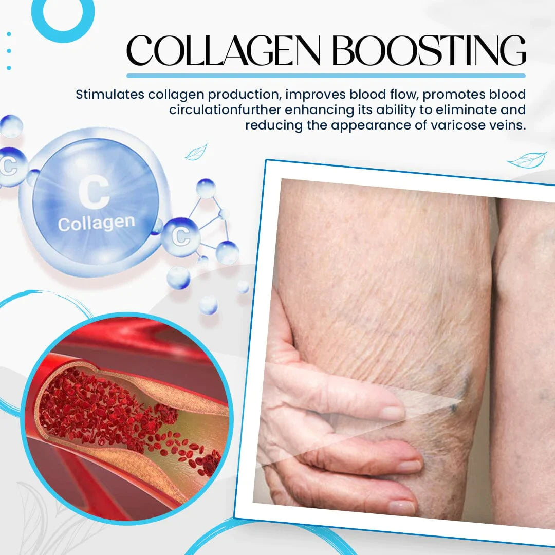 Varicose Veins Treatment Cream