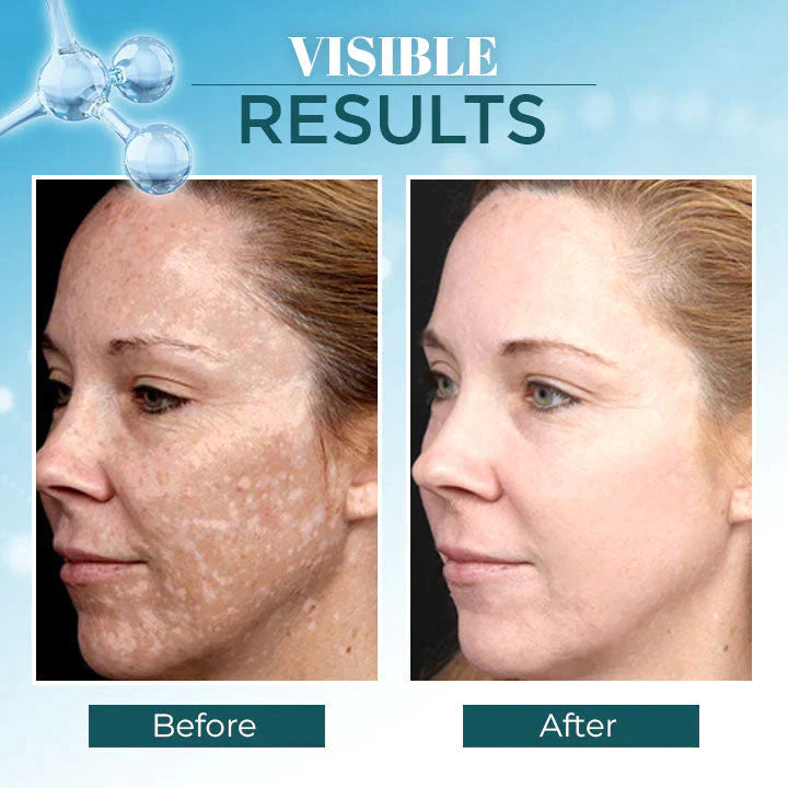 Triple-Active Brightening Dark Spot Corrector Remover