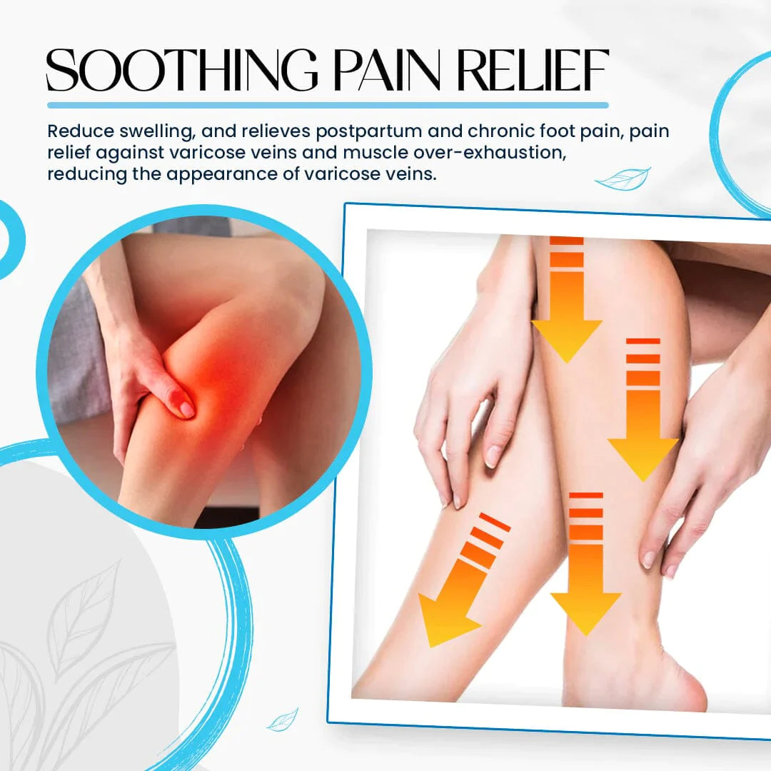 Varicose Veins Treatment Cream