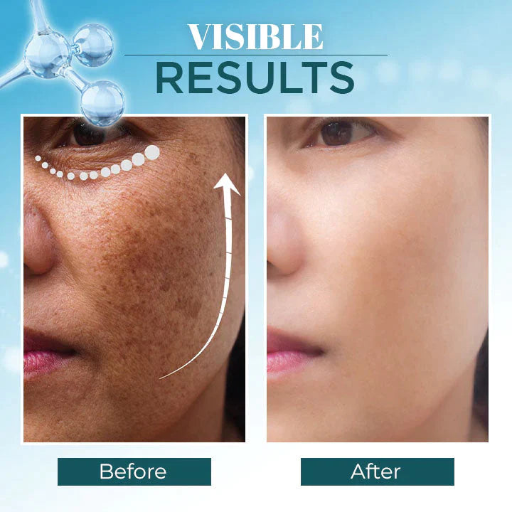 Triple-Active Brightening Dark Spot Corrector Remover