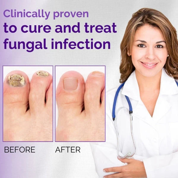 Nail Fungal Essence